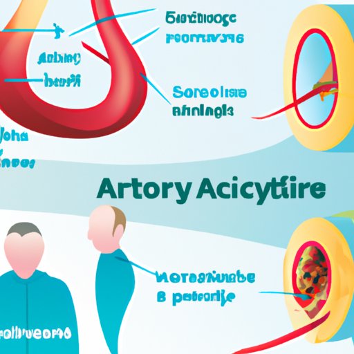 How to Know If Your Arteries Are Clogged: Signs, Diagnosis and ...