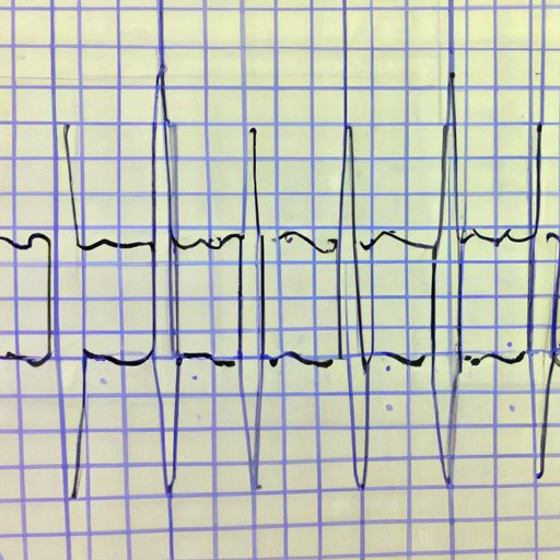 how-does-an-ekg-work-exploring-the-anatomy-mechanics-and-benefits-of