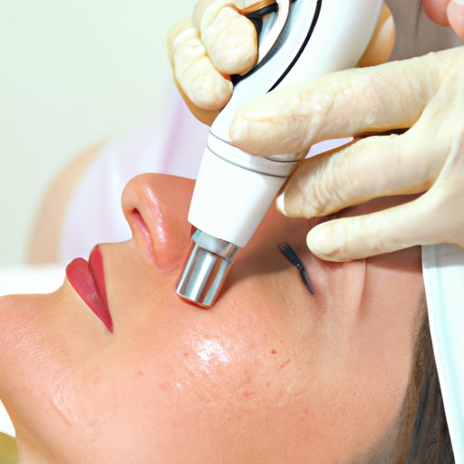 Exploring How Does Microneedling Work Benefits Risks And Techniques The Enlightened Mindset