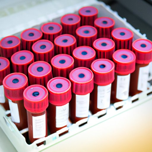 how-long-does-a-blood-culture-take-exploring-the-factors-that-affect