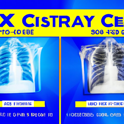 How Much Would A Chest X Ray Cost