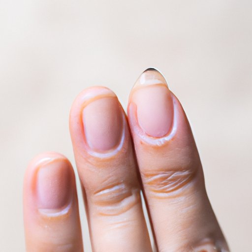 What Do Your Fingernails Say About Your Health? | A Comprehensive Guide ...