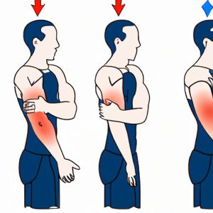 Why Can’t I Straighten My Arm After Working Out: Causes, Solutions, and ...